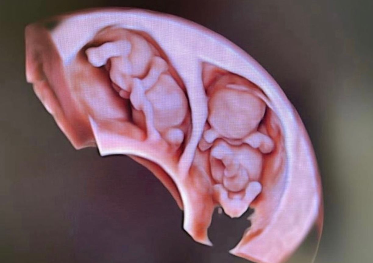 Annette Valerie Gaspard-2