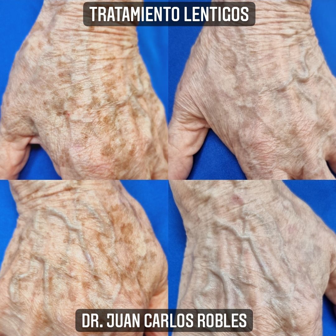 Juan Carlos Robles Méndez-30