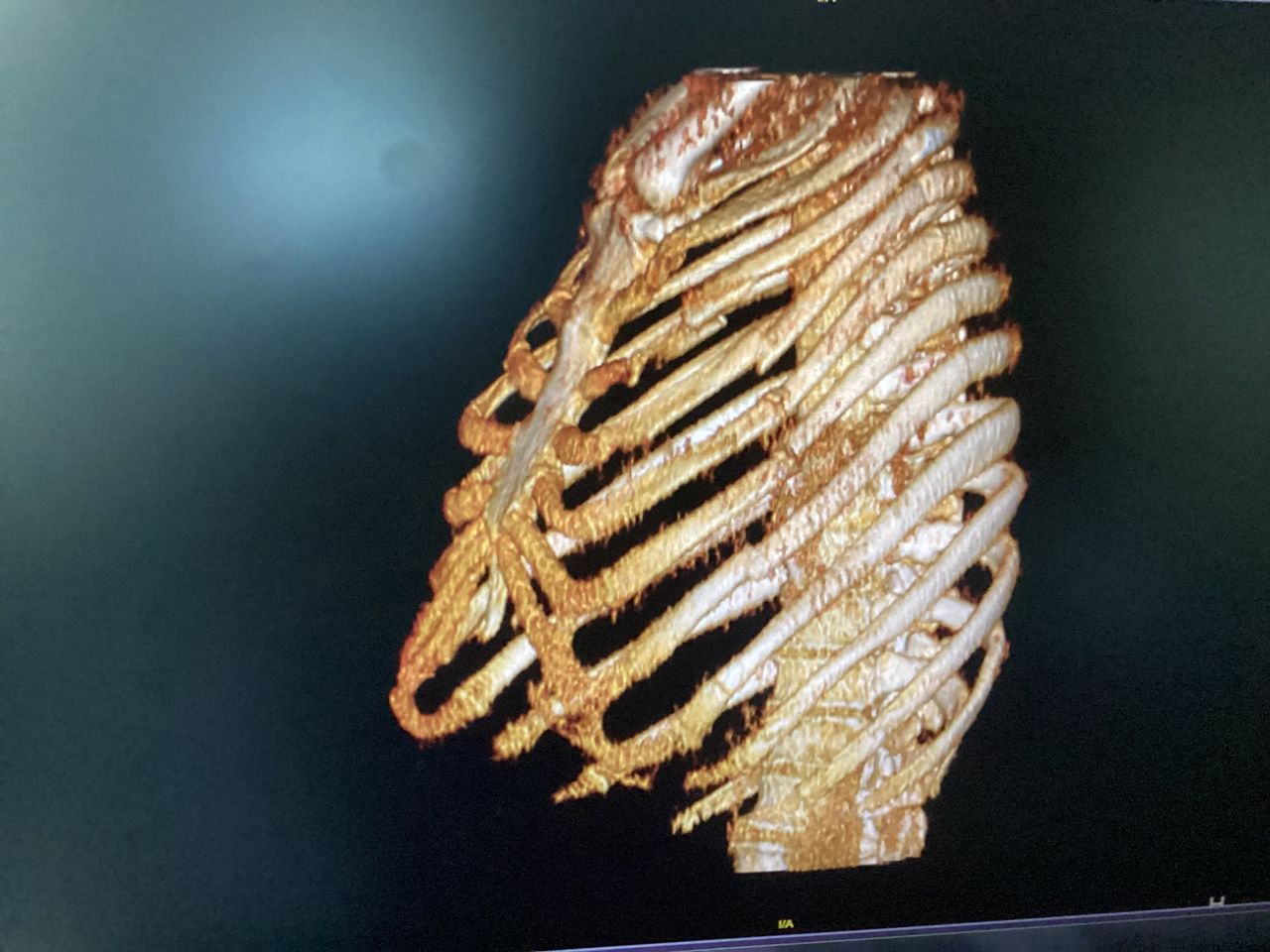 Luis Alberto Quispe Fernandez-6