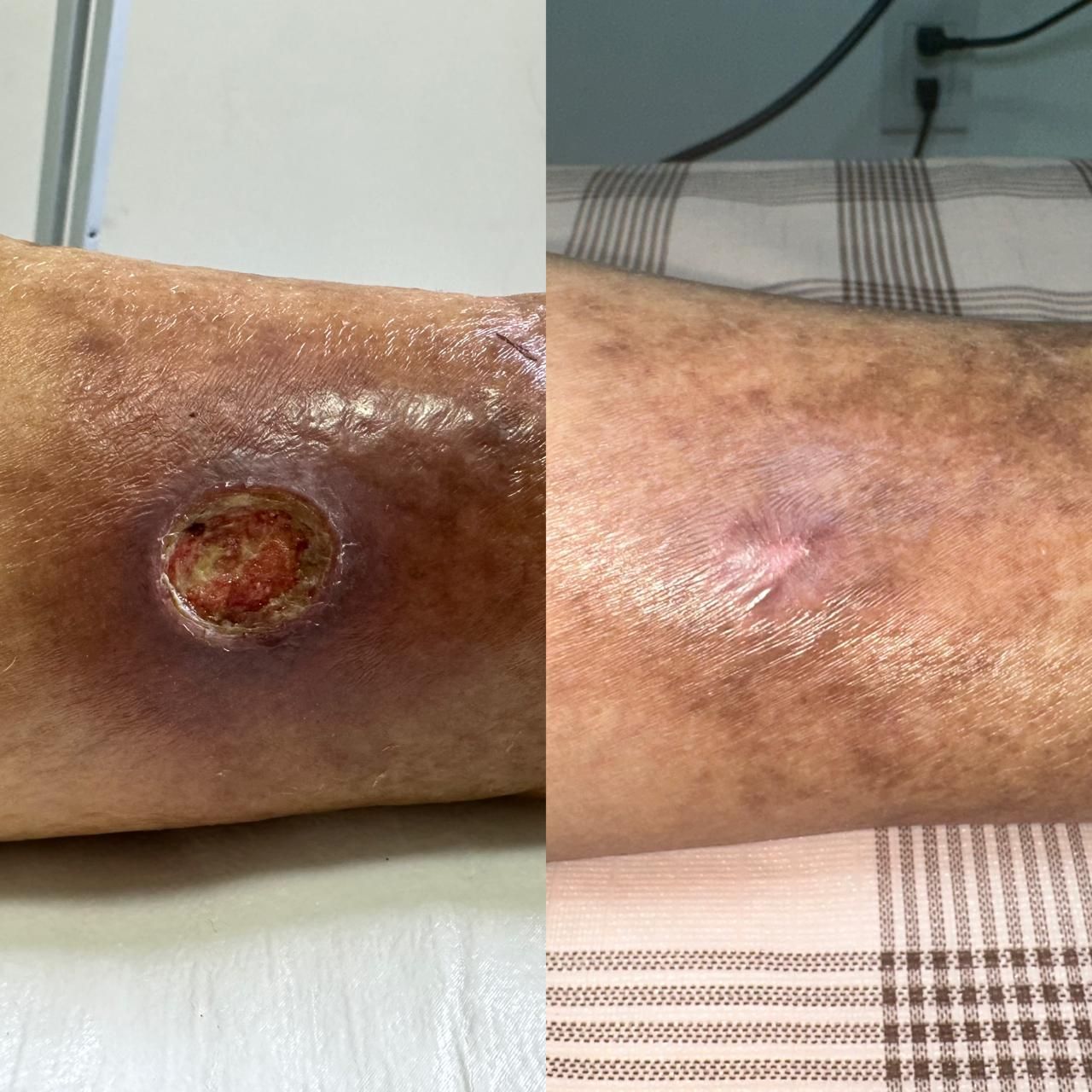 Jhonatan López González-47