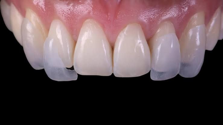 Raúl Méndez Cifuentes-0