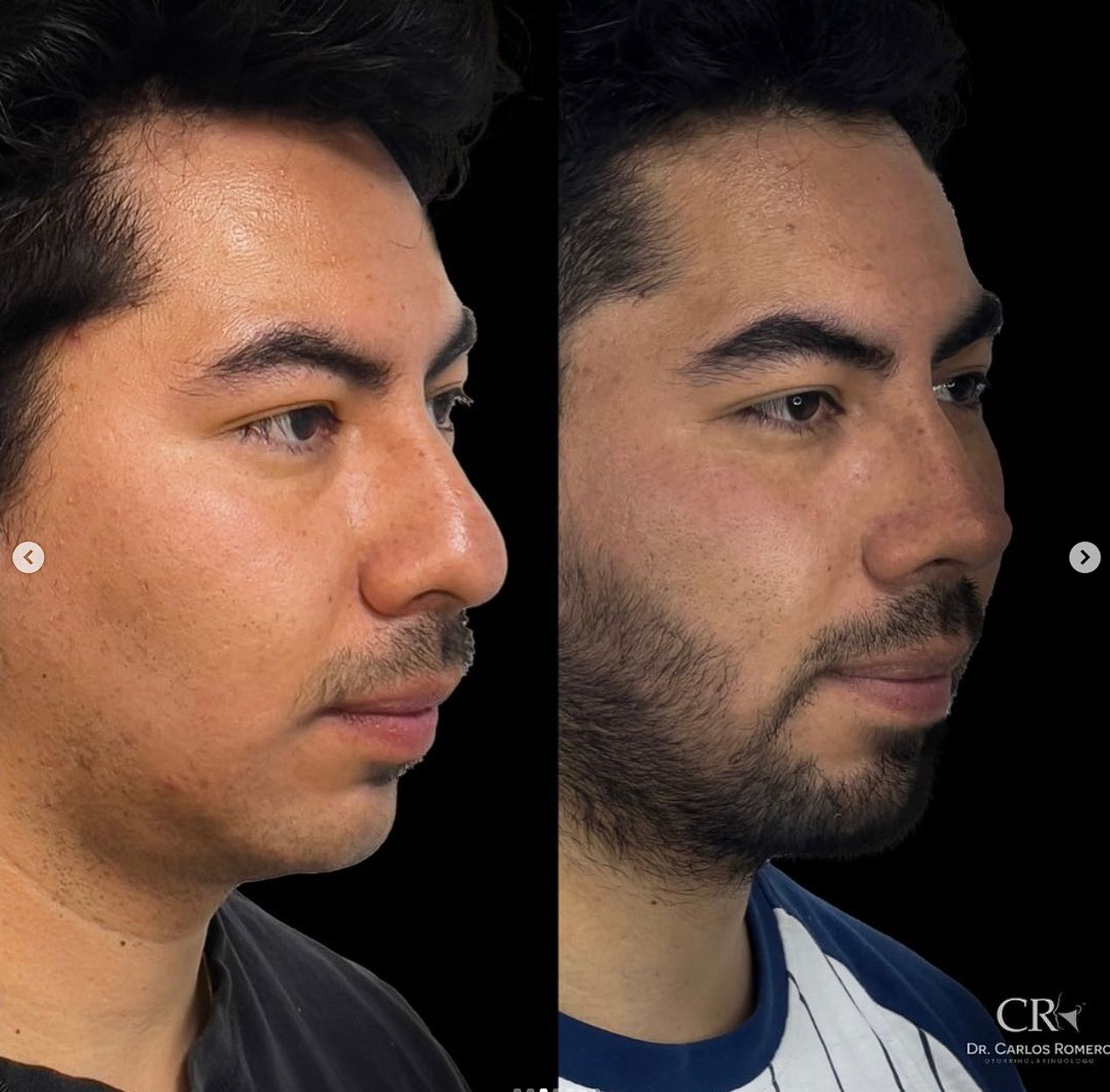 Carlos Alfonso Romero Gameros-22