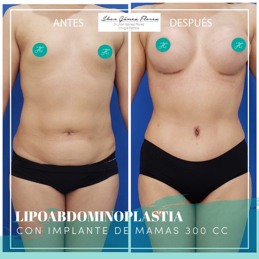 Jhon César Gómez Florez-54