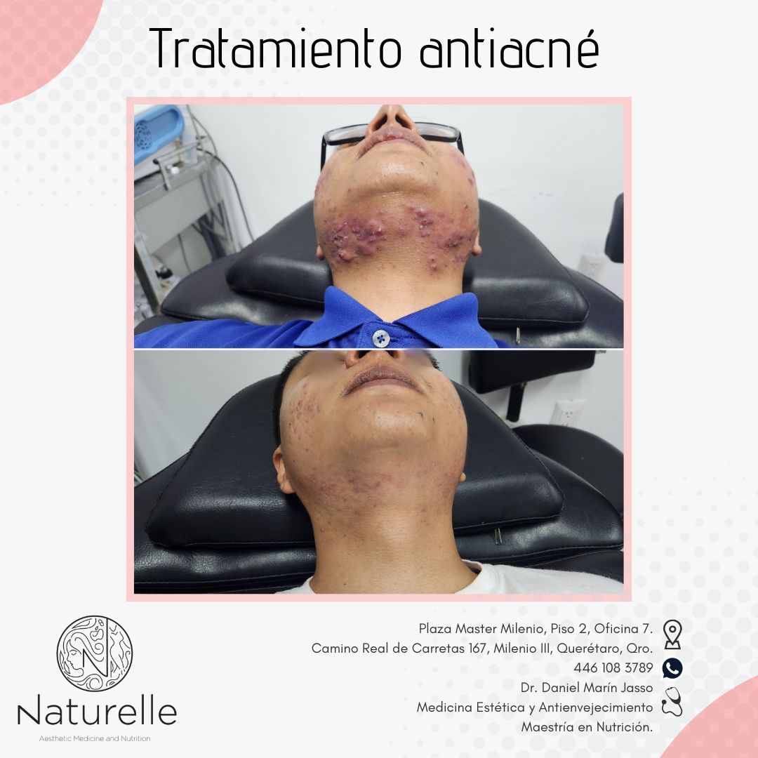 Daniel Marín Jasso-9