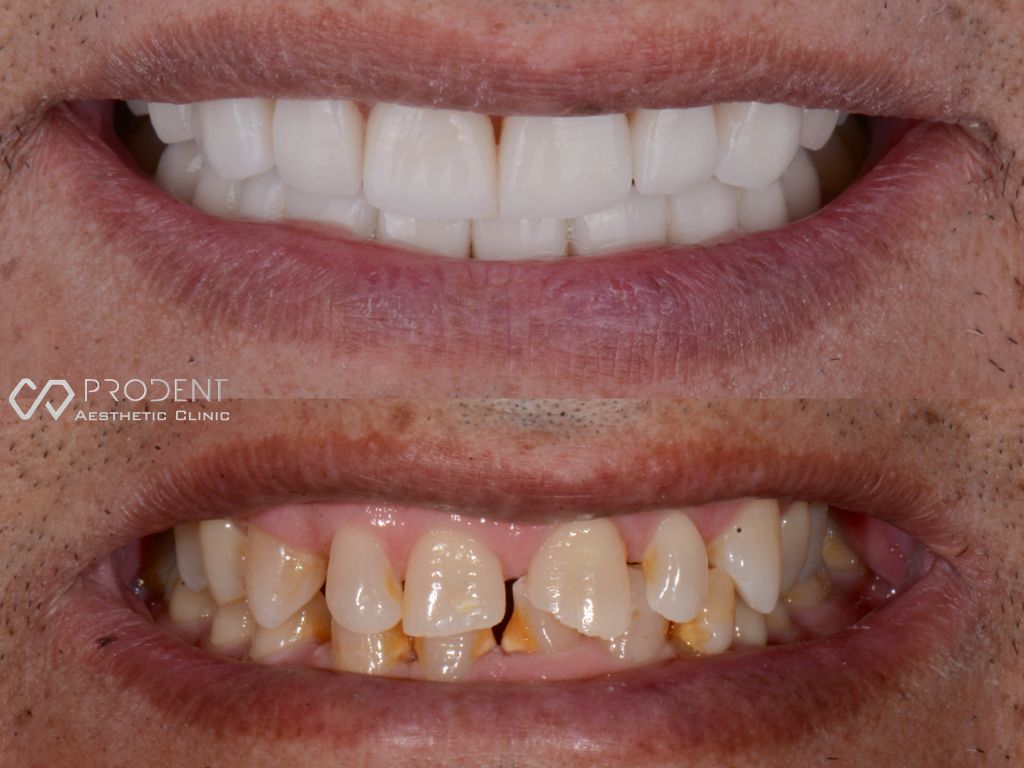 Ramiro Ivan Pérez Murillo-32