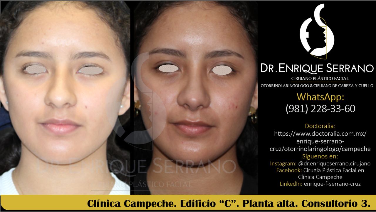 Enrique Serrano Cruz-69