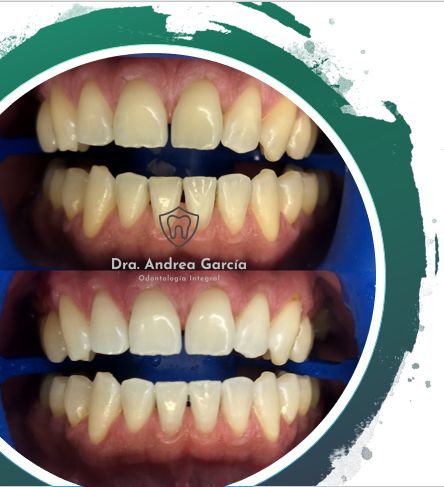 Andrea Hernández Garcia-12