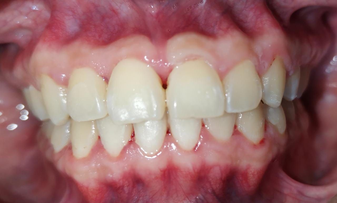 Emma Selenia Hernández Castillo-24