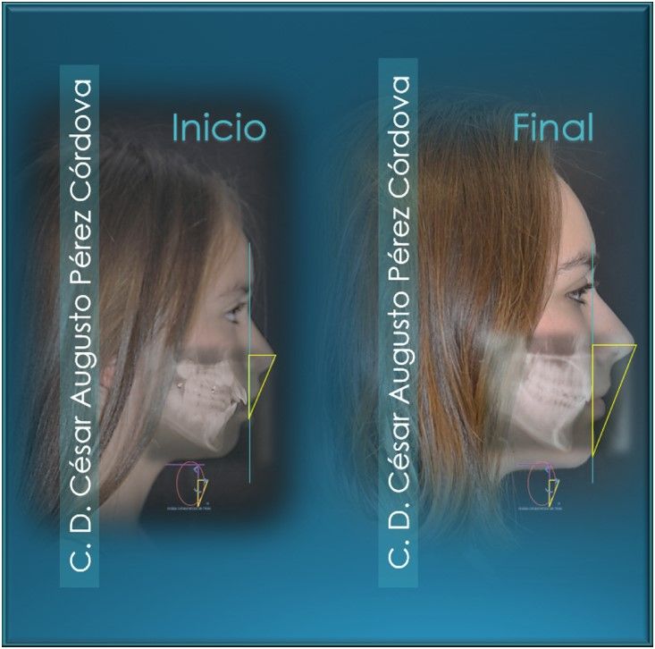 César Augusto Pérez Córdova-37