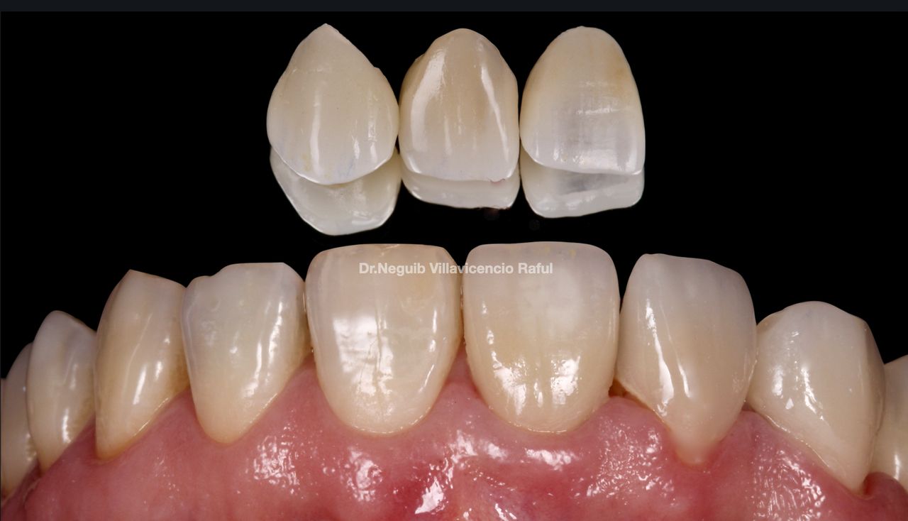 Neguib Villavicencio Raful-46