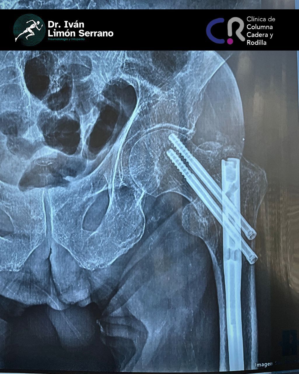 Iván Limón Serrano-39