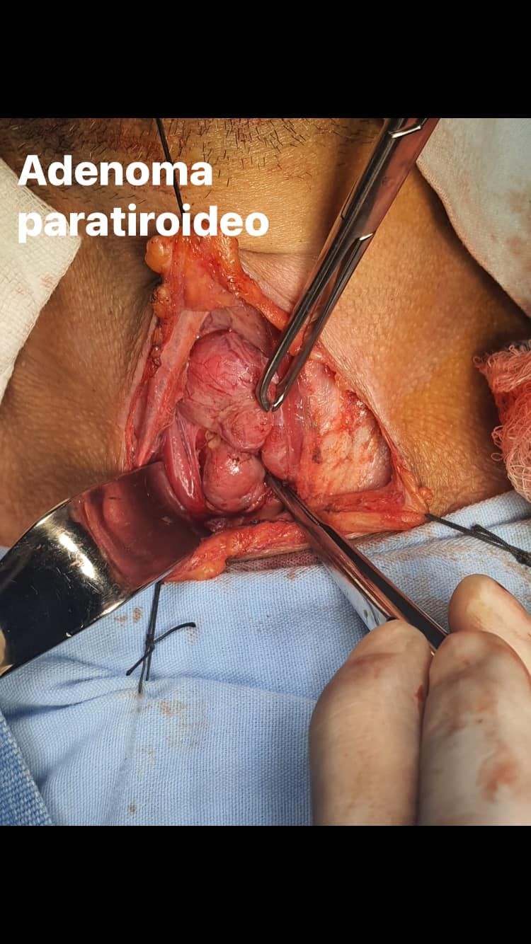 Samuel Irisson Mora-5