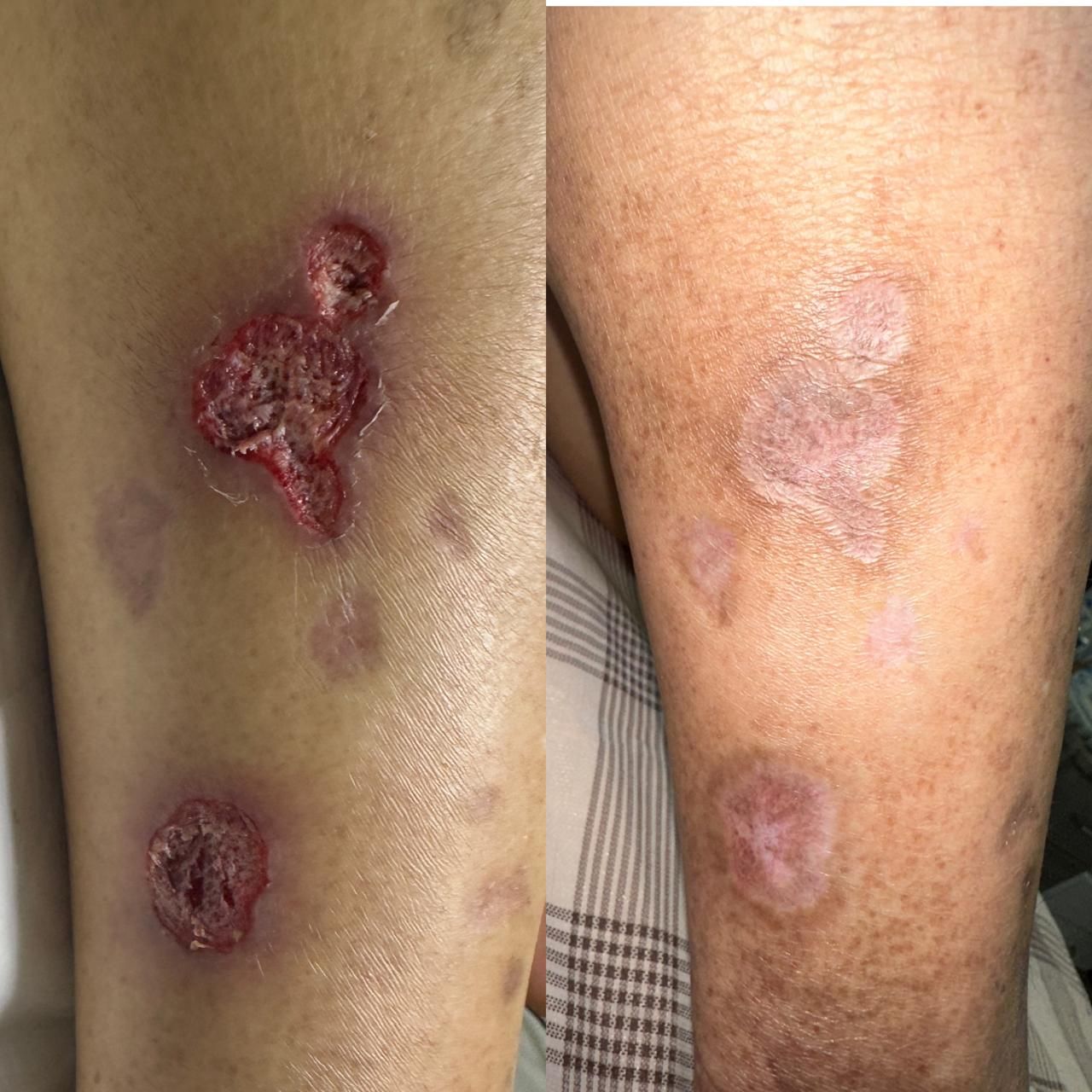 Jhonatan López González-45