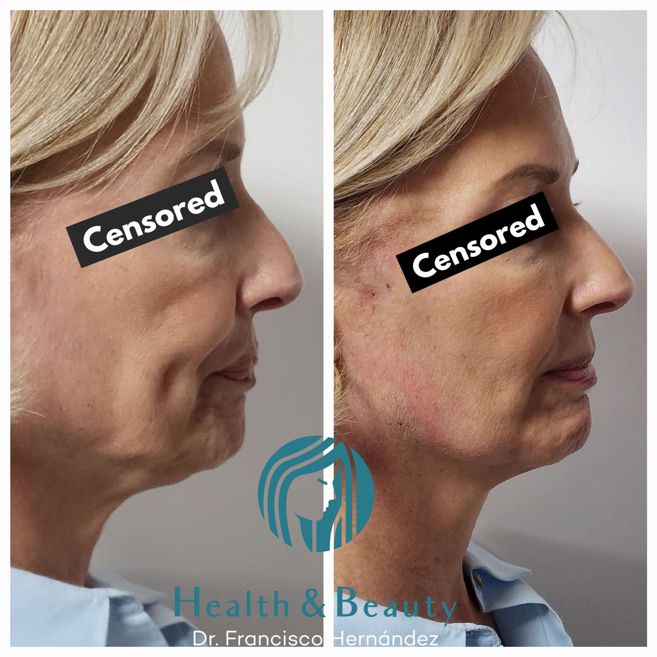 Francisco Hernández Gómez Crespo-52