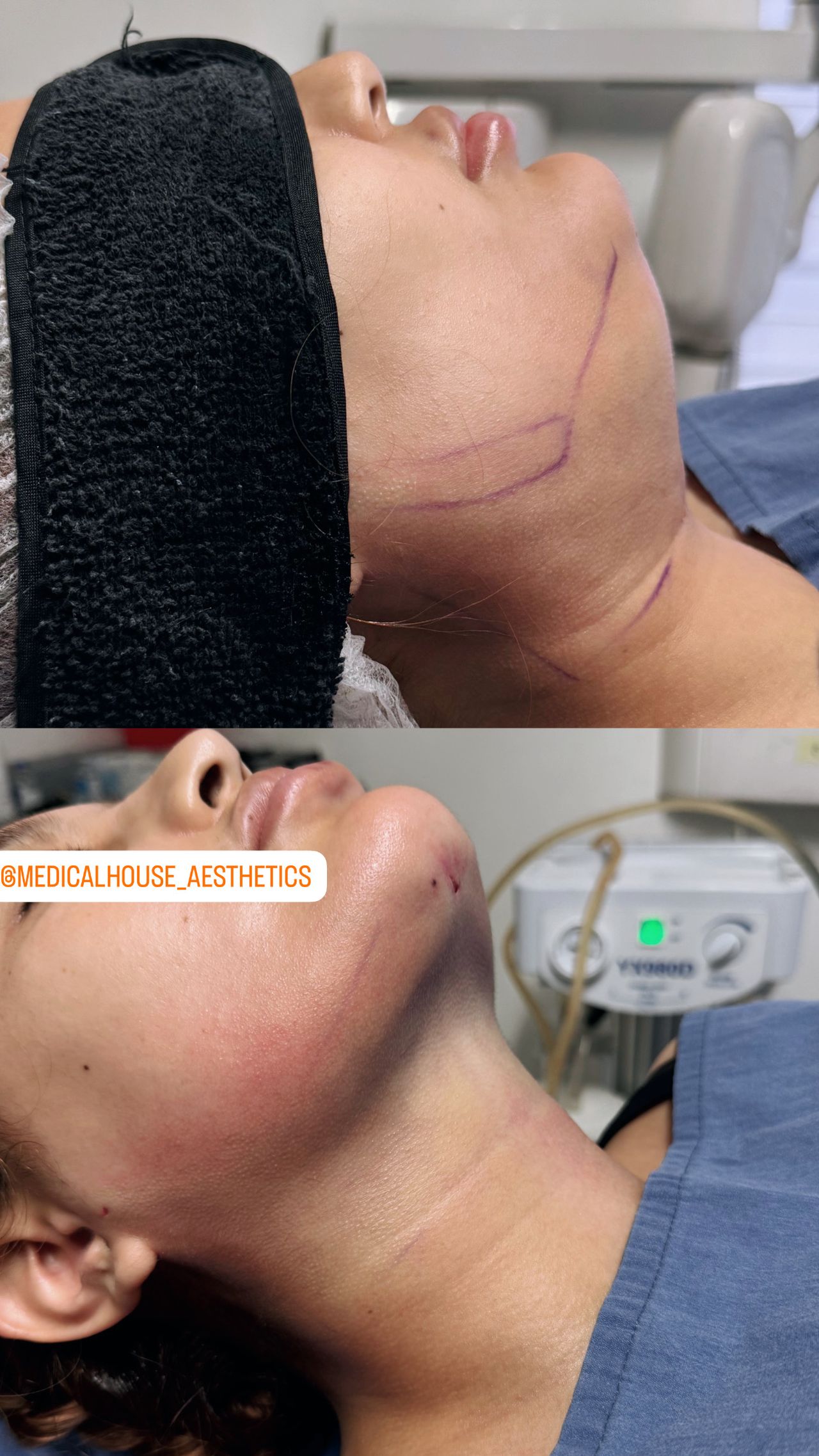 Miguel Angel Aguirre-12