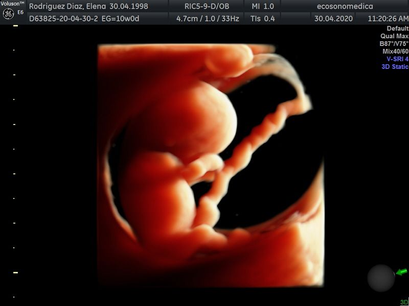 Héctor Bernardo Acevedo Manrique-8