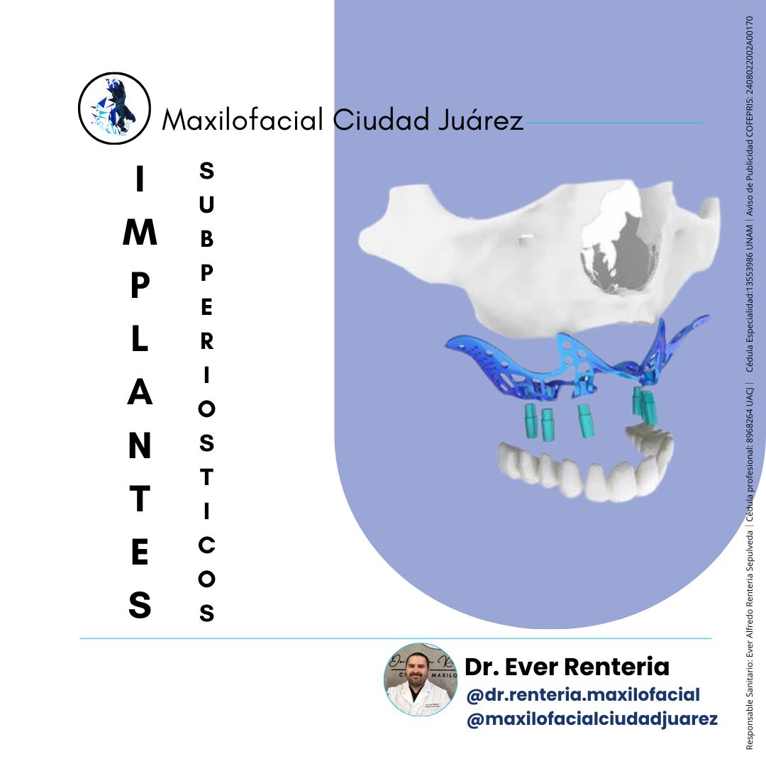 Ever Renteria Sepulveda-9