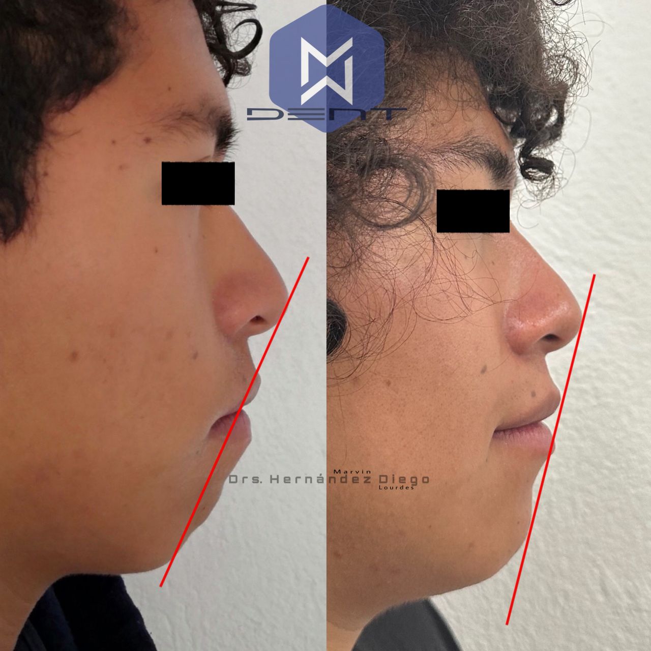 Marvin Adair Hernández Álvarez-12