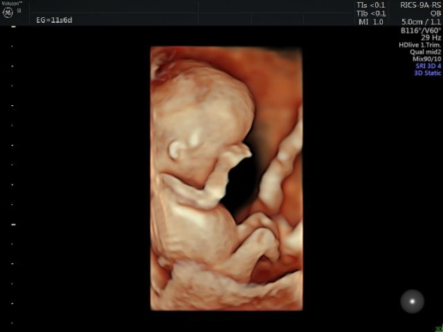 Katia Yareli Viera Ibarra-9