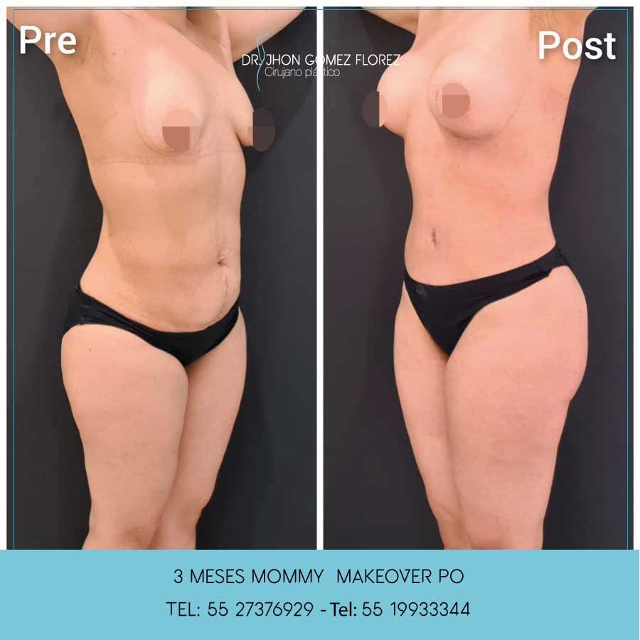 Jhon César Gómez Florez-4