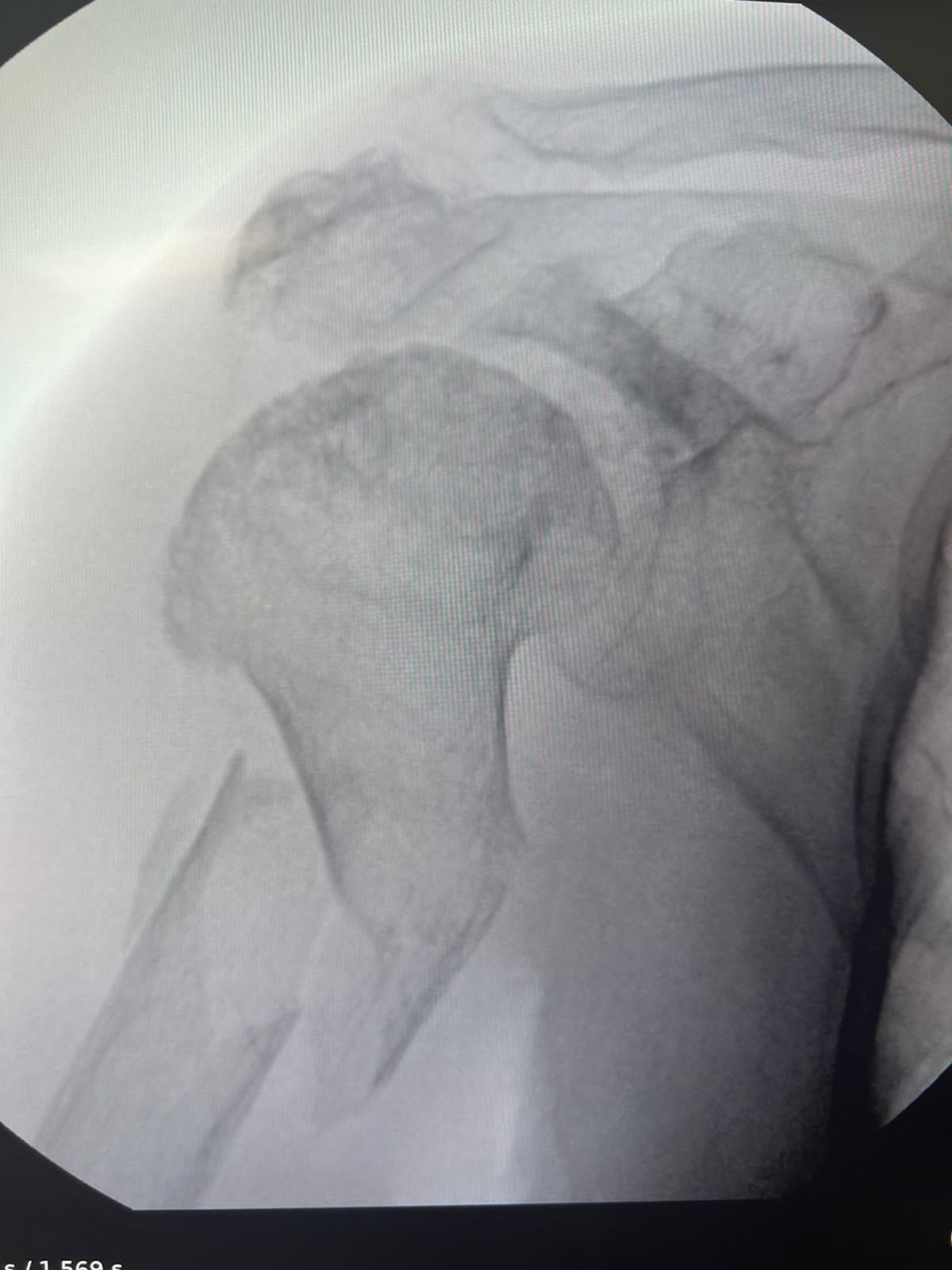 Oscar Alberto Pérez Peralta-29