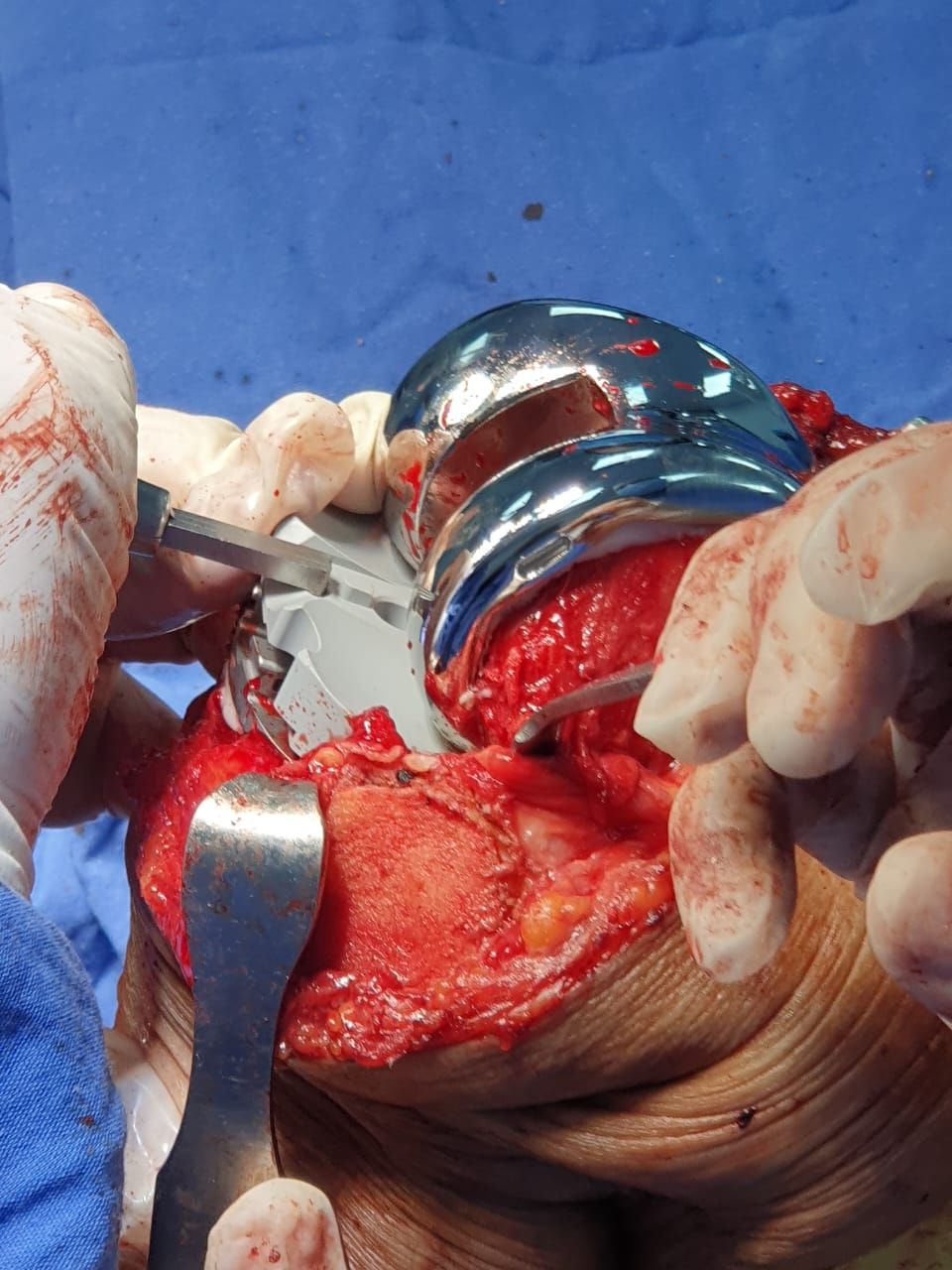 Carlos Horacio Sanchez Rodrigo-21