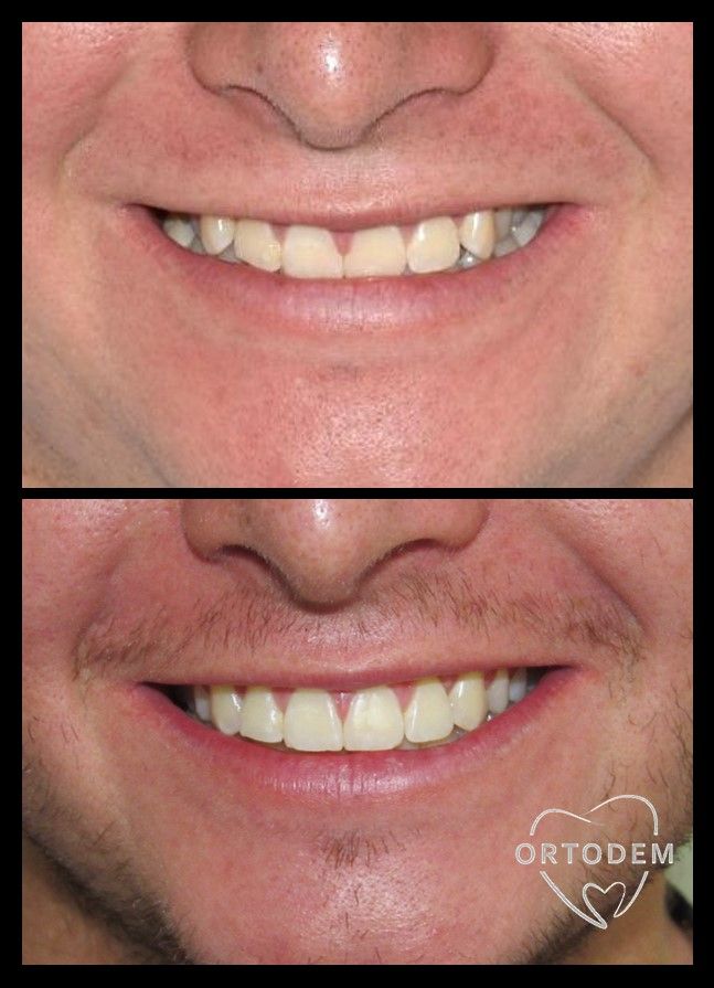 Elizabeth Morelos Morales-8