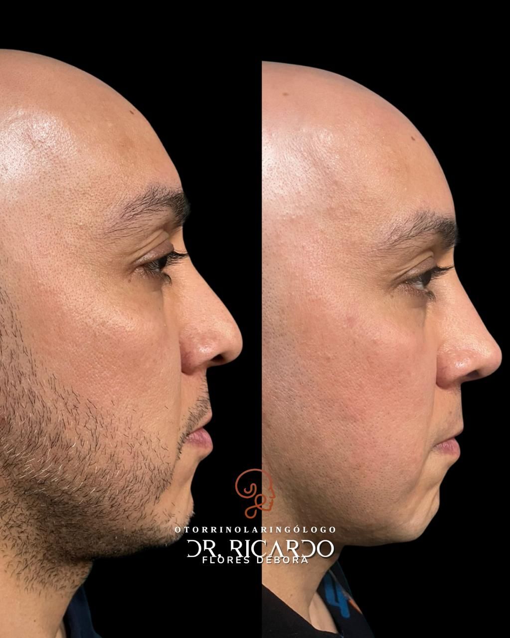 Ricardo Flores Débora-11