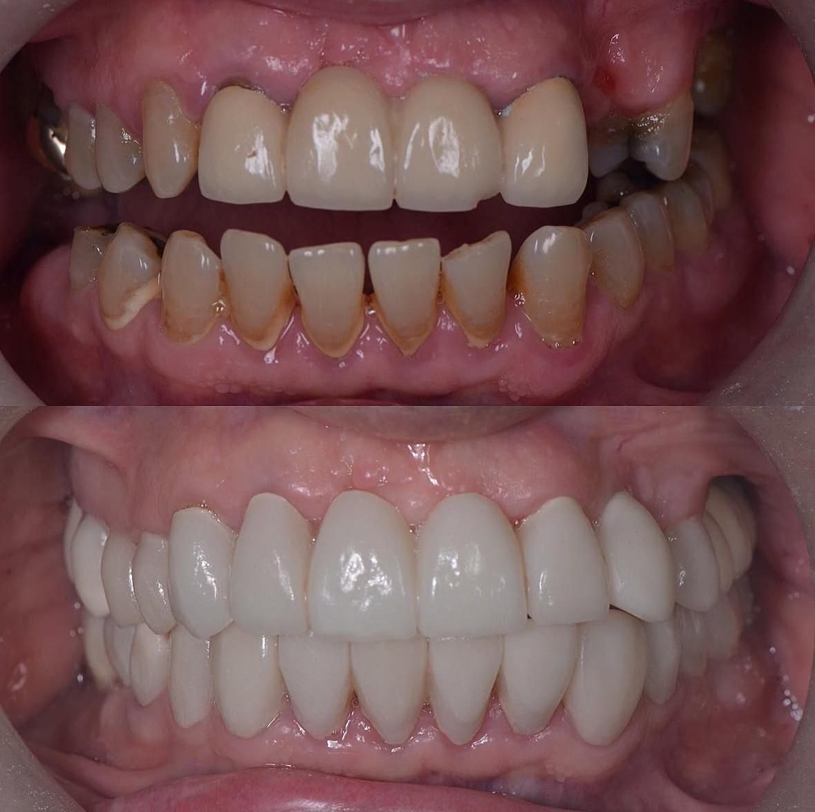 Luis Armando Mendívil Barreras-18