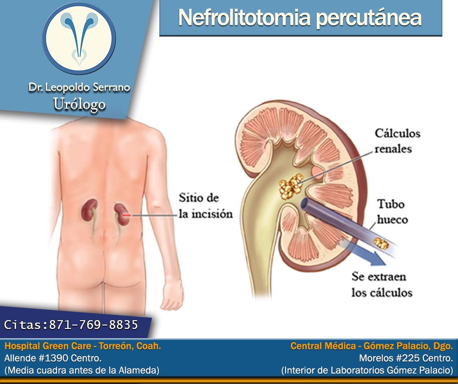 Erik Leopoldo Serrano Ortega-23