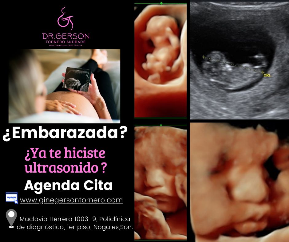 Gerson Tornero Andrade-4