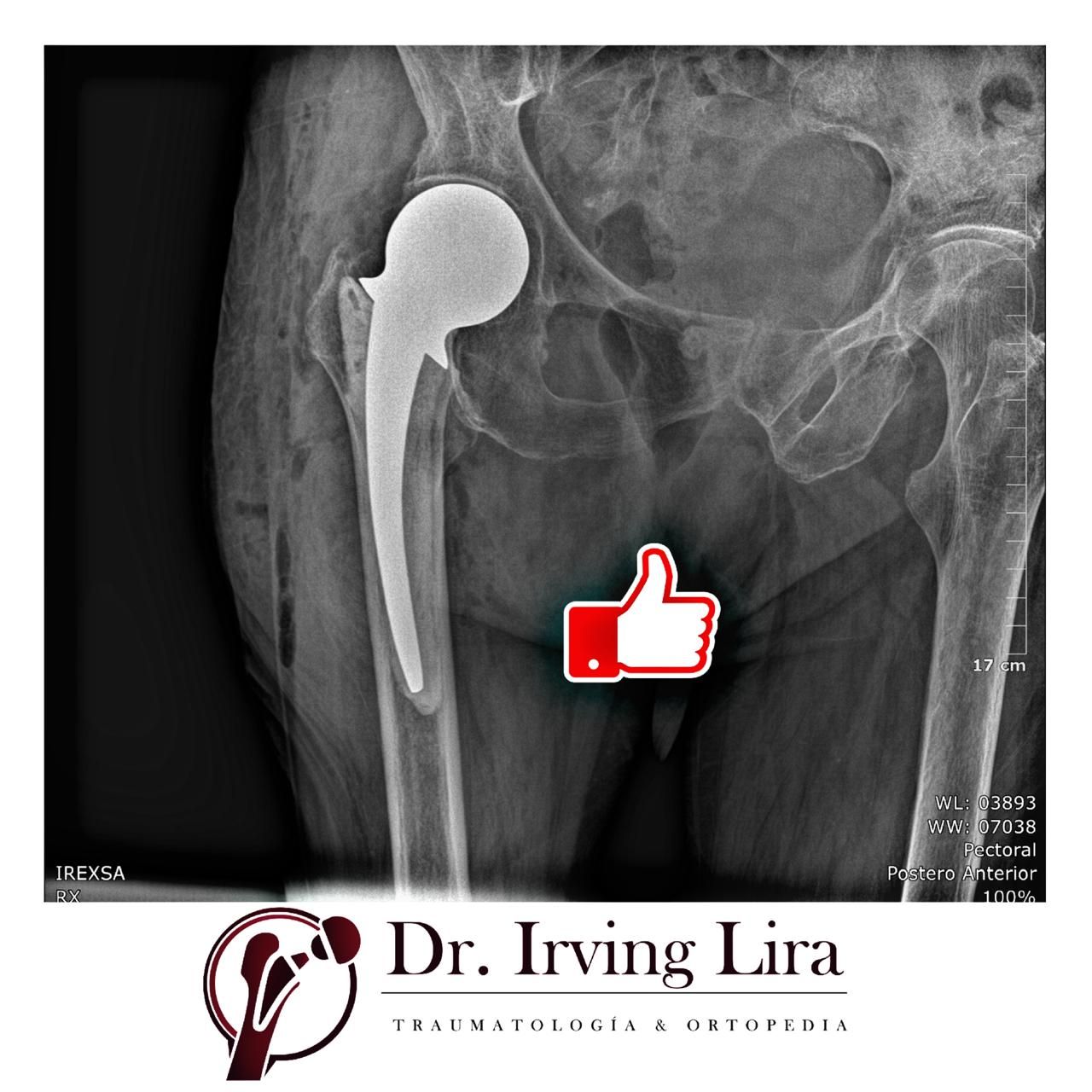 Irving Fernando Lira Ruiz-20