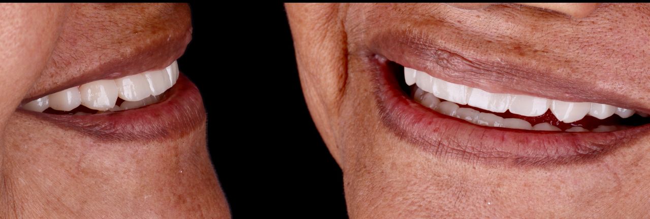 Alexandro Castrellon-7