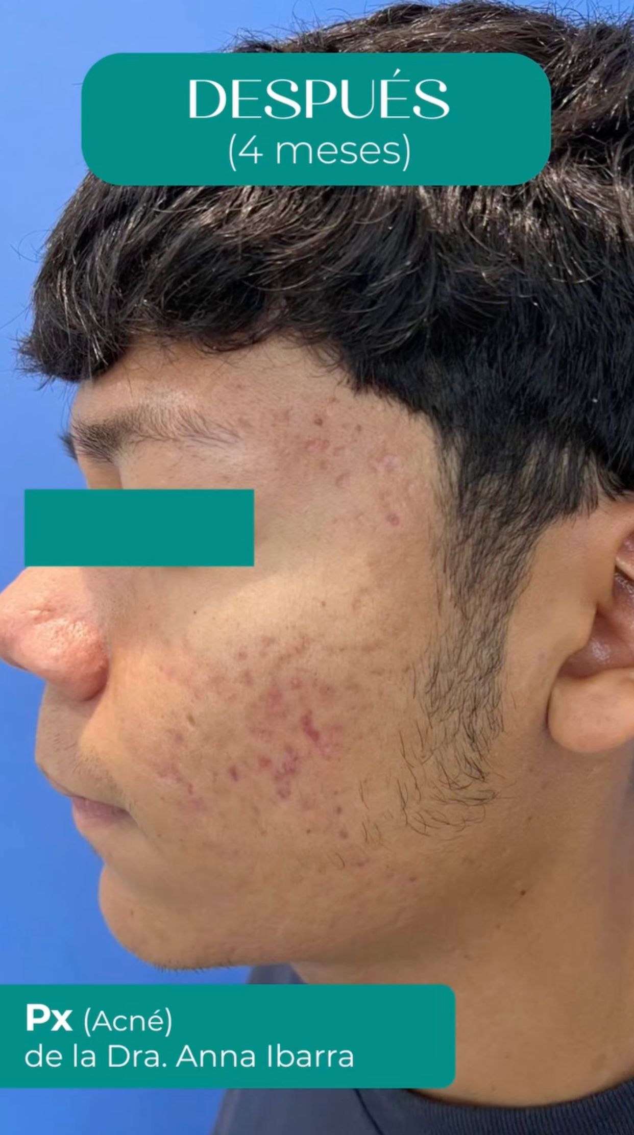 Anna Luisa Ibarra Puentes-18