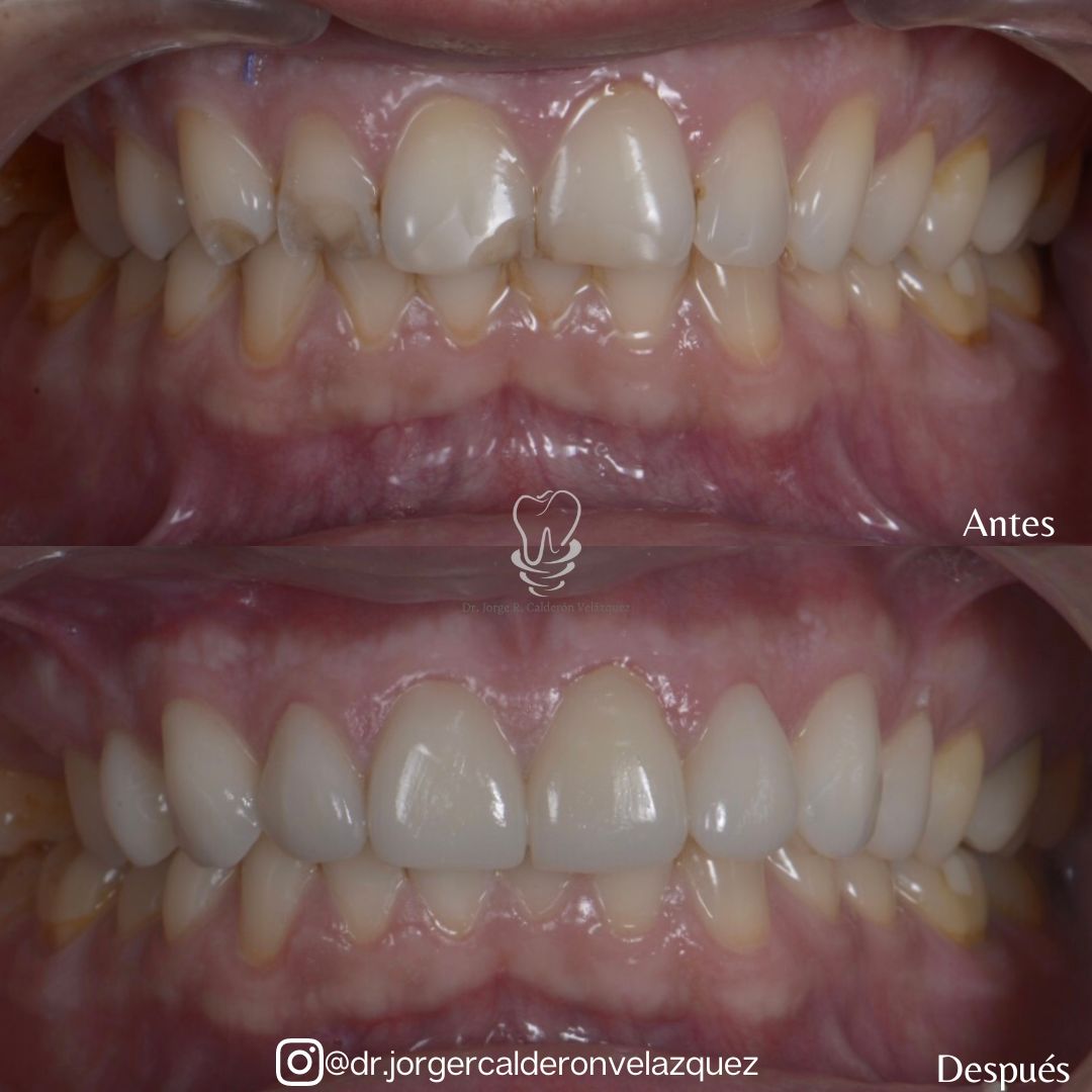 Jorge Rafael Calderón Velázquez-8