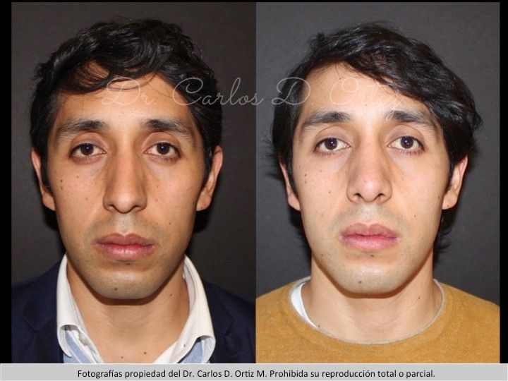 Carlos David Ortiz Moreno-27