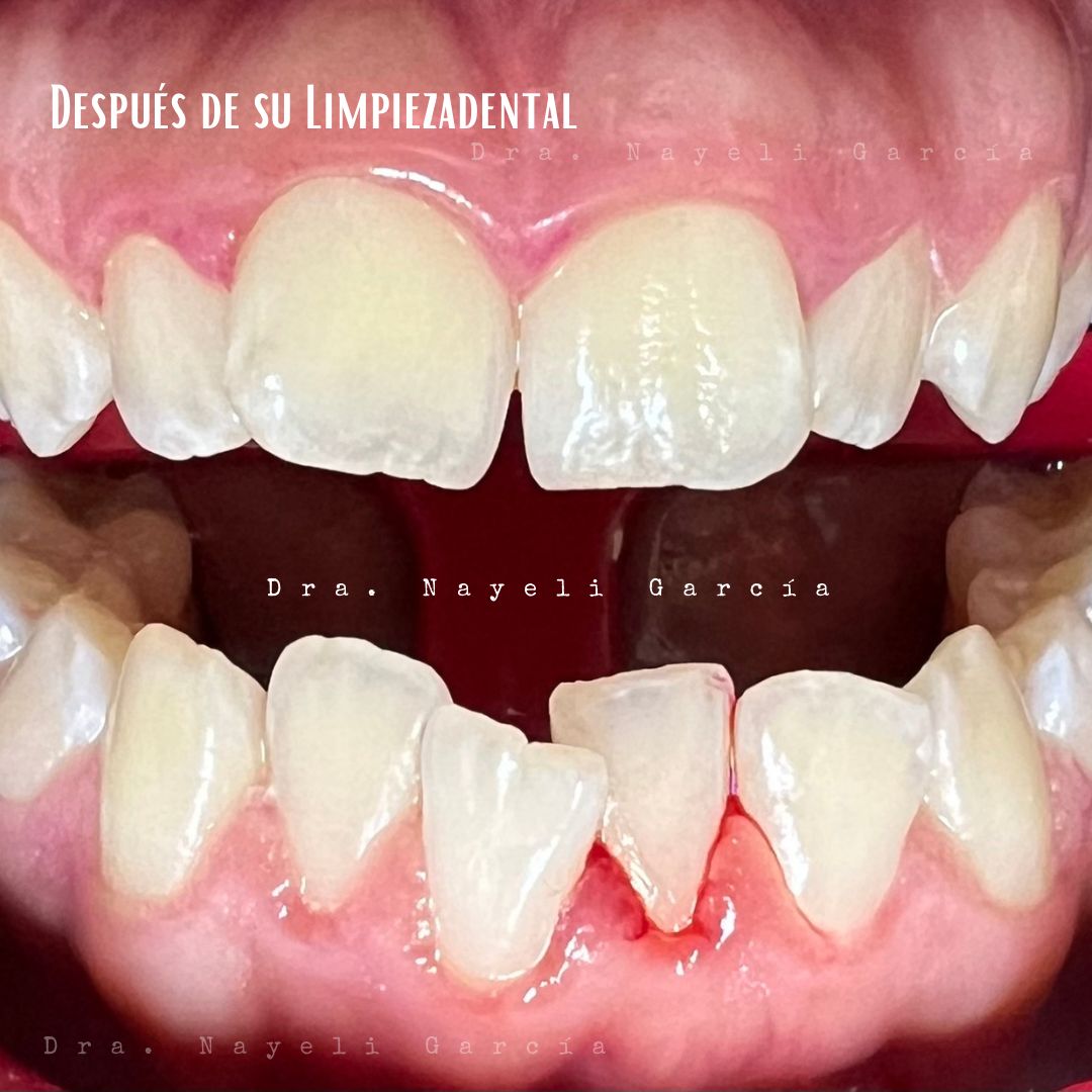 Nayeli Garcia Morales-31