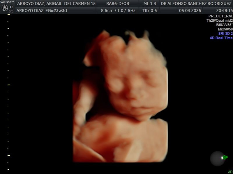 Alfonso Sanchez Rodriguez-65