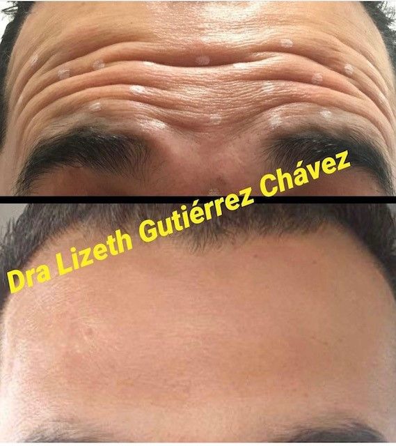 Lizeth Alejandra Gutiérrez Chavéz-5