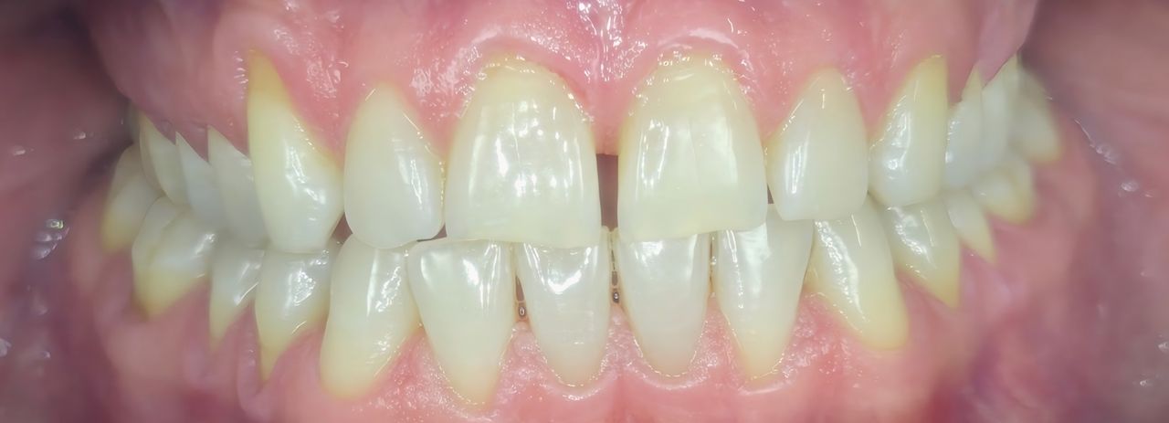 Edgardo Caballero Dávila-14