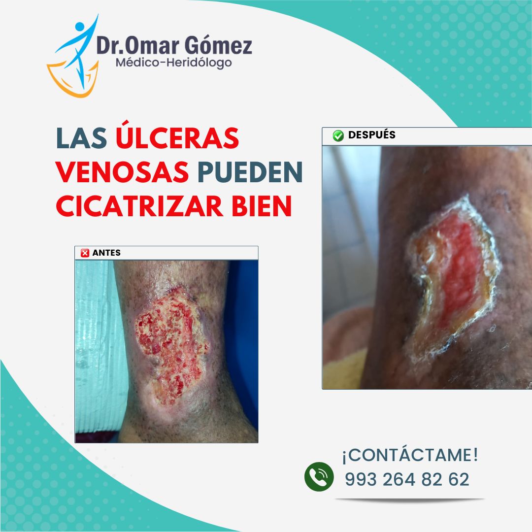 Omar Gómez López-7