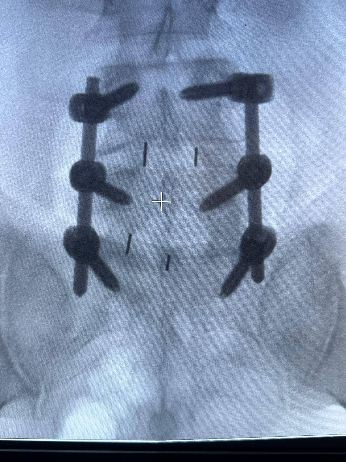 Gerson Reyes Rodríguez-29