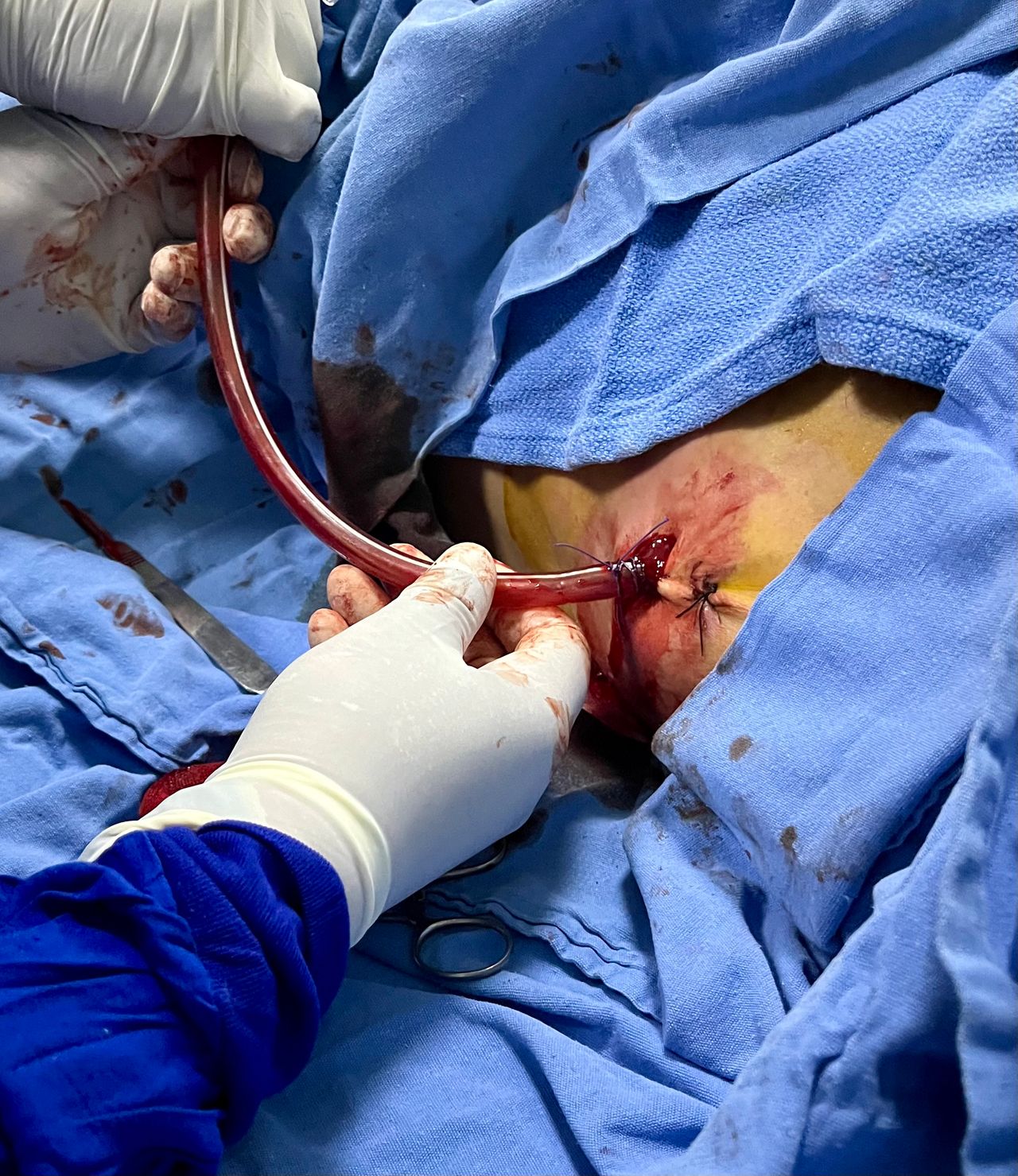 Rogelio Hernández García-93