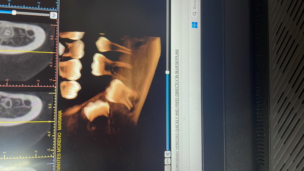 Christian Belen Mendoza Hernandez-5