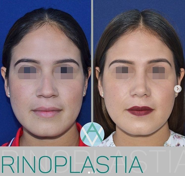 Alfonso Villaseñor Herrero-12