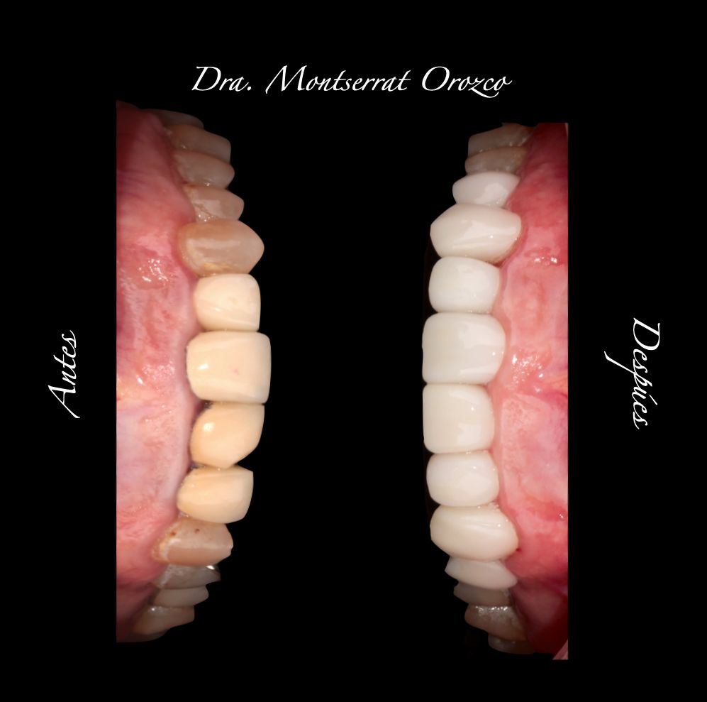 Aide Montserrat Orozco Gutierrez-53