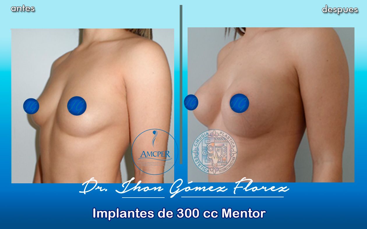 Jhon César Gómez Florez-34