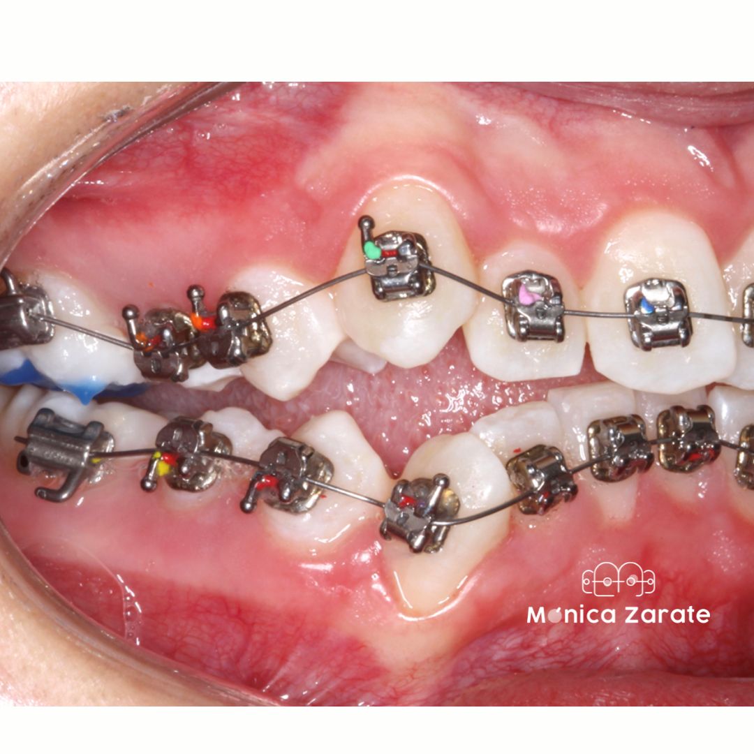 Mónica Isabel Zárate Pérez-17