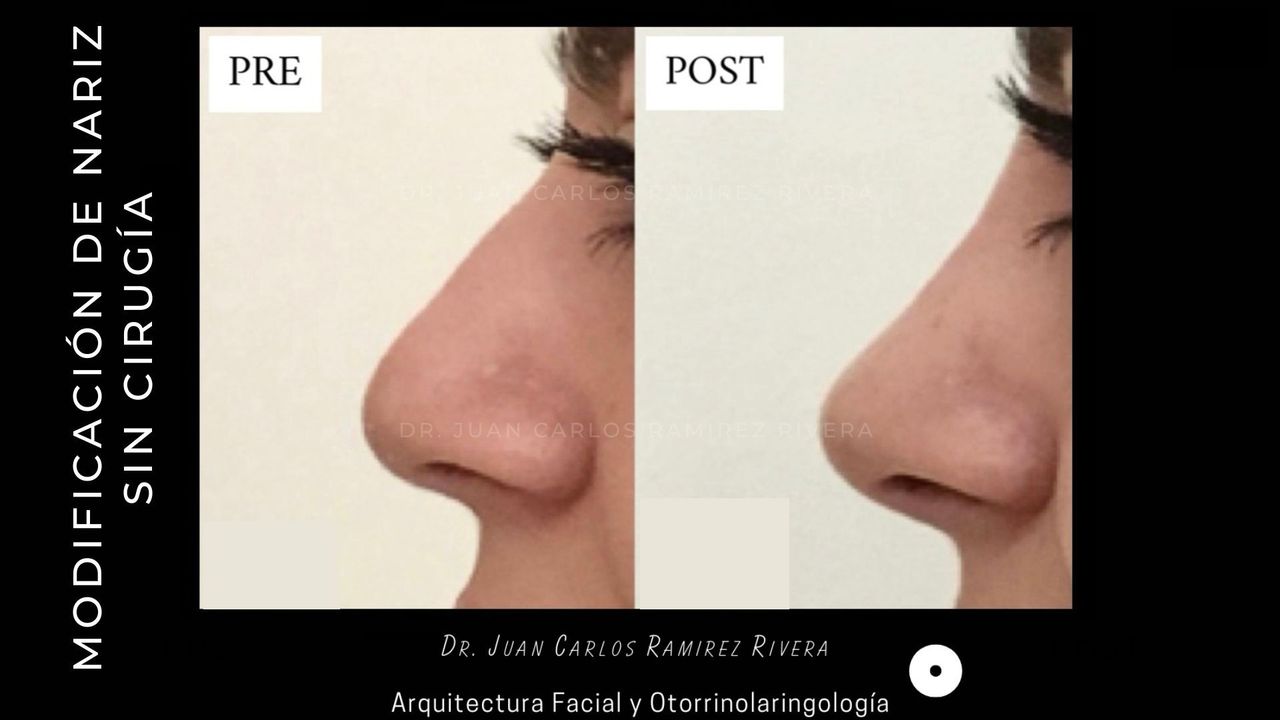 Juan Carlos Ramirez Rivera-5