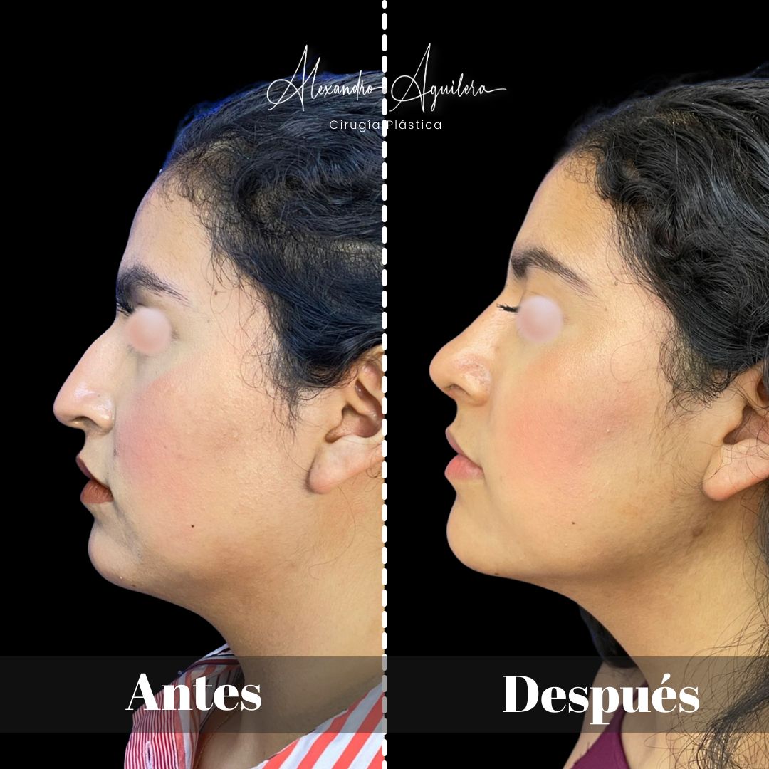 Alexandro Aguilera Salgado-28